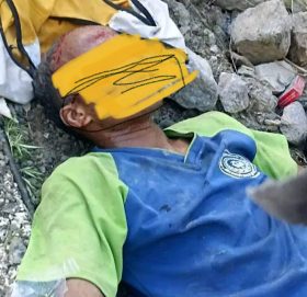 नेपालगंज बाट खाध्यान्ह बाेकेर  हुम्ला जाँदै गरेकाे ट्रक दुर्घटना