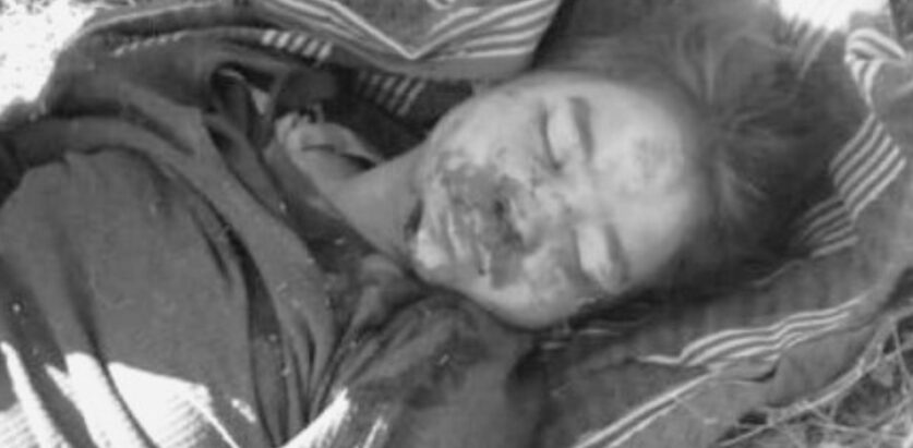 भीरबाट लडेर घाईते भएकी बालिकाको उपचारका क्रममा मृत्यु