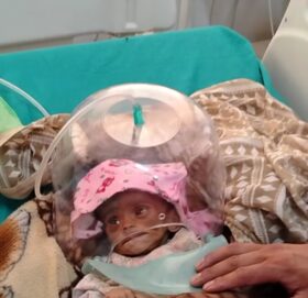 कुपोषणका कारण २ महिने बालिकाकाे अस्पतालमा नै मृत्य